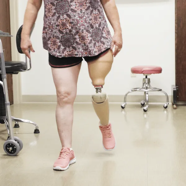 Above-Knee (Transfemoral) Prosthesis